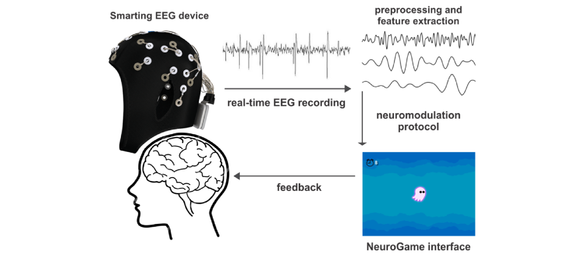 Evaluation of the Effectiveness of a Novel Brain-Computer Interface Neuromodulative Intervention to Relieve Neuropathic Pain Following Spinal Cord Injury: Protocol for a Single-Case Experimental Design With Multiple Baselines 
